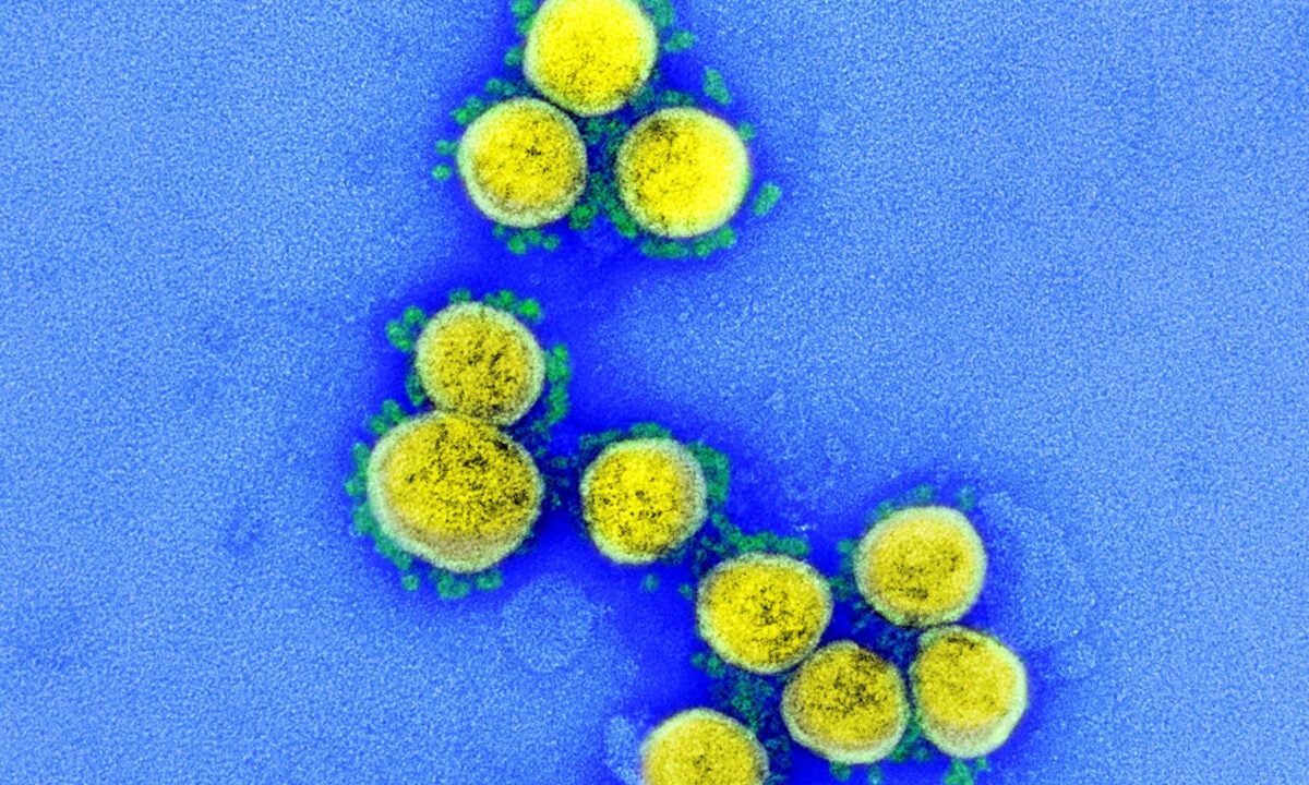 At-home COVID-19 test study launches in Boston